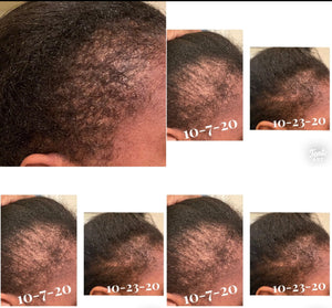 Schey oil hair growth